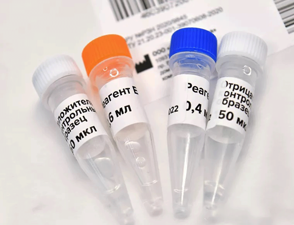U Rusiji registrovan test za otkrivanje antitela na virus korona